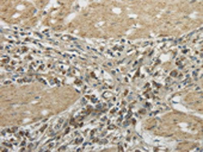 TRIB2 Antibody