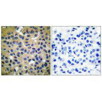 COL2A1 Antibody
