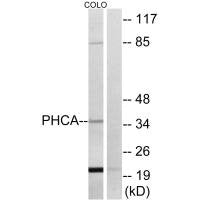 ACER3 Antibody