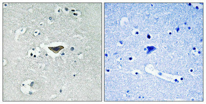 Phospho-RASGRF1 (Ser916) Antibody