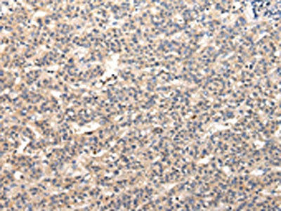 VPS37A Antibody