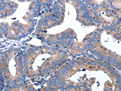 APAF1 Antibody
