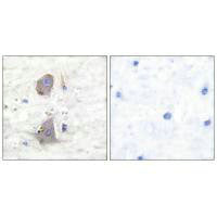 SLC2A1 Antibody
