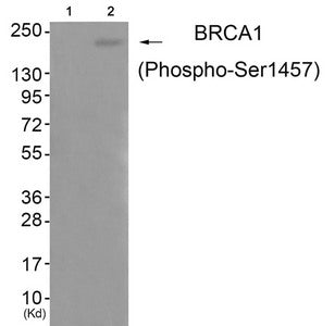 Phospho-BRCA1 (Ser1457) Antibody