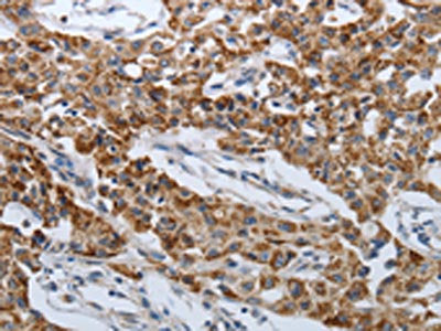 SPAG1 Antibody