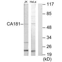 ZNHIT6 Antibody