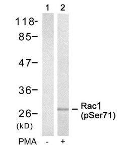 Phospho-RAC1 (Ser71) Antibody