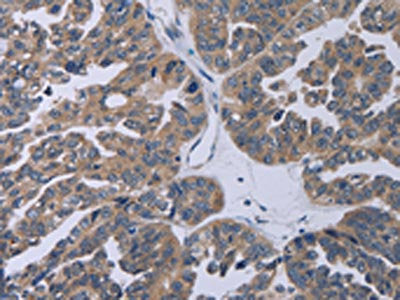 TP53AIP1 Antibody