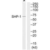 RPS6KA5 (Ab-564) Antibody