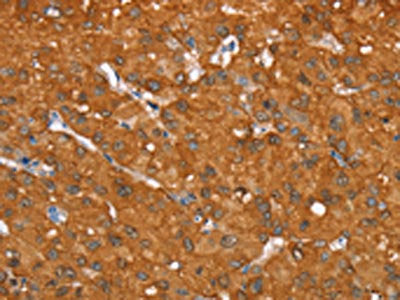 AKR1C4 Antibody