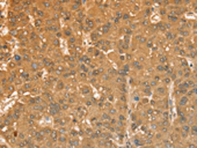 CXCR4 Antibody