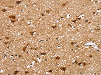 SSBP4 Antibody