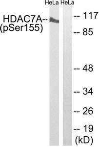 Phospho-HDAC7 (Ser155) Antibody