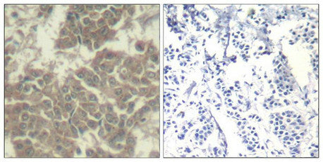JAK2 (Ab-570) Antibody