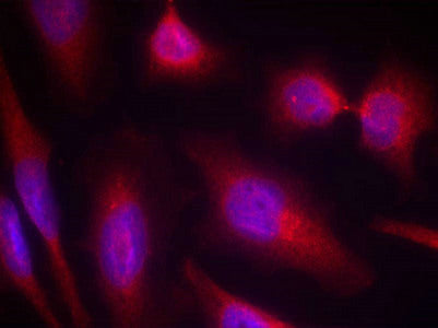 MAPT (Ab-214) Antibody