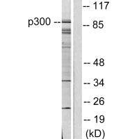 EP300/CREBBP Antibody
