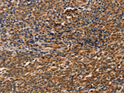 CCR5 Antibody