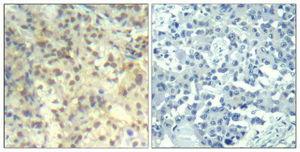 Phospho-CFL1 (Tyr139) Antibody