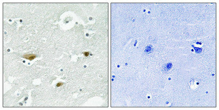 Phospho-STK39 (Ser325) Antibody