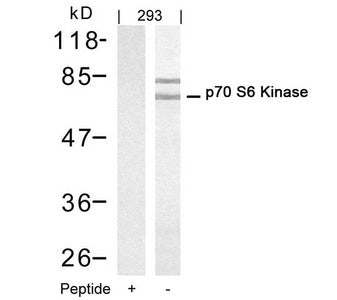 RPS6KB1 (Ab-421) Antibody