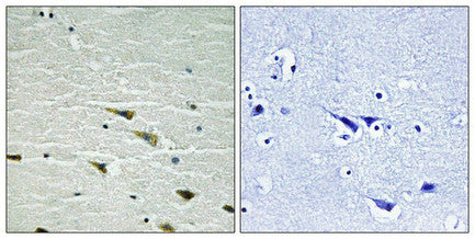 Phospho-NTRK1 (Tyr757) Antibody