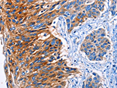 CLEC2B Antibody