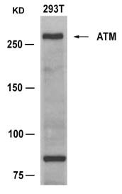 ATM (Ab-1981) Antibody