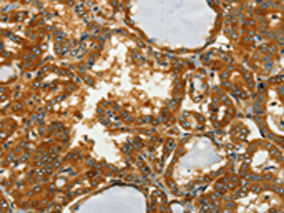 GOT1 Antibody