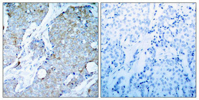 KDR (Ab-1214) Antibody