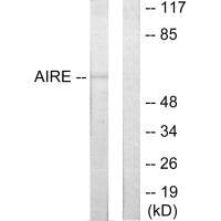 AIRE Antibody