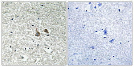 Phospho-IRAK1 (Ser376) Antibody