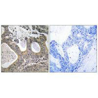 STEAP2 Antibody