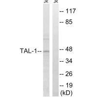 TAL1 (Ab-122) Antibody