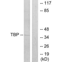 TBP Antibody