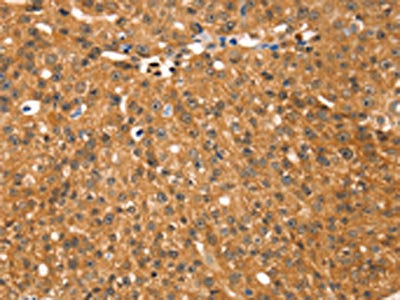 RGS22 Antibody