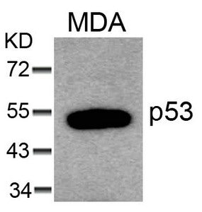 TP53 (Ab-6) Antibody