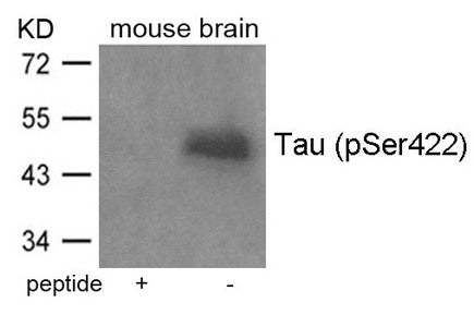 Phospho-MAPT (Ser422) Antibody