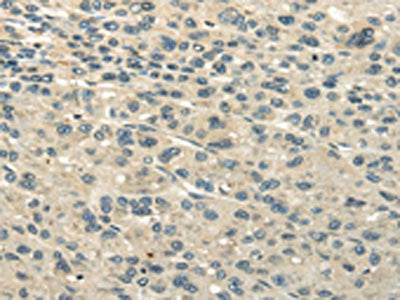 UBAP2L Antibody