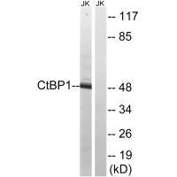 CTBP1 (Ab-422) Antibody