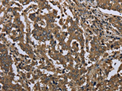 GOLGA2 Antibody