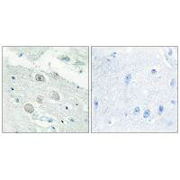 JAK1 Antibody