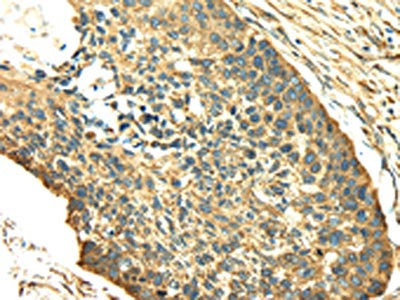 SDF4 Antibody