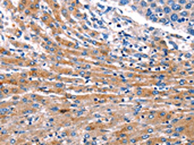 CDK5 Antibody