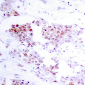 MEF2A (Ab-319) Antibody
