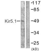 KCNJ16 (Ab-416) Antibody