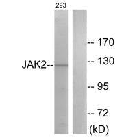 JAK2 (Ab-570) Antibody