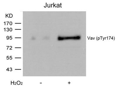 Phospho-VAV1 (Tyr174) Antibody