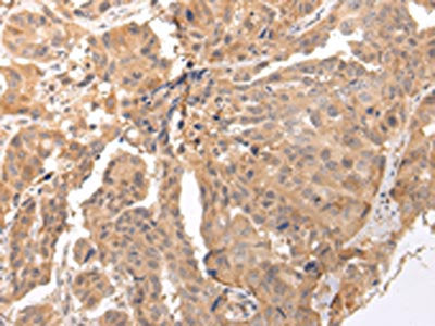 CLDND2 Antibody