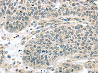 THAP4 Antibody