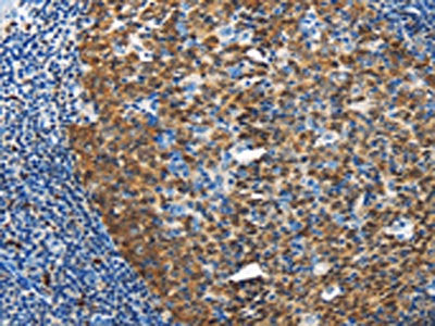 DCK Antibody